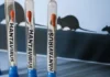 Hantavirus: Could This Rare Virus Become The Next Pandemic After Covid? Hantavirus: Could This Rare Virus Become The Next Pandemic After Covid?